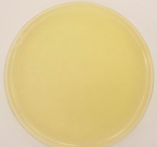 Nutrient Agar, Prepared Media Plates, 100 x mm, Pack 5 | KLM Bio Scientific