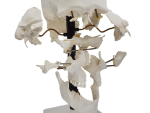 Beauchene Exploded Skull Model - 13 Parts - Life Size - Mounted on Stand